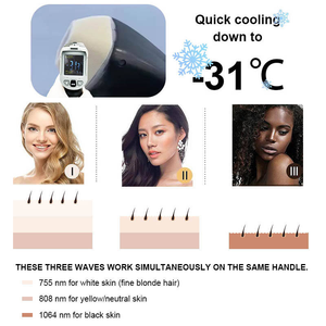 TRiple Wave Ice Titanium Platinum Laserdiode Hair Removal Machine 755 1064 808nm DiodeLaser Hair Removal - Product Image 3