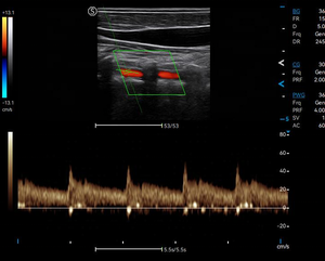 Échographe Doppler Couleur SIUI Apogee C2 de Haute Qualité et Économique avec Longue Durée de Vie pour Usage Vétérinaire - Product Image 5