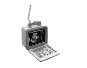 Test di gravidanza Scanner ad ultrasuoni 3D sistema diagnostico ad ultrasuoni