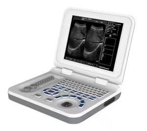 دفتر <span class=keywords><strong>S30</strong></span> الأكثر مبيعًا للموجات فوق الصوتية الطبية B/W S50A بالموجات فوق الصوتية ثنائي الأبعاد للحمل النسائي USG - Product Image 1