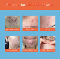 Patch Hydrocolloïde Anti-Acné à Couleur Changeante, Traitement Invisible et Fin pour les Boutons, Soin de la Peau du Visage, Logo Personnalisé OEM