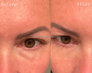 Vente chaude OEM 60 Secondes <span class=keywords><strong>Crème</strong></span> <span class=keywords><strong>Anti</strong></span>-<span class=keywords><strong>Rides</strong></span> Instantanée pour les Yeux avec Effet Visible - Product Image 4