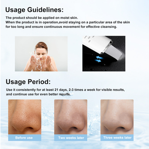 Exfoliante Facial Ultrasónico Eléctrico IPX7 a Prueba de Agua, Limpiador de Poros, Elimina Puntos Negros, Exfoliante Facial Ultrasónico - Product Image 5