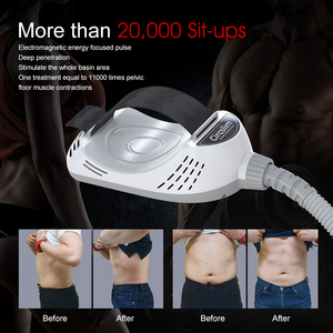 Estimulador EMS Electromagnético Circslim 2 con 2 Manijas, Máquina para Adelgazar y Perder Peso para Uso Comercial - Product Image 2