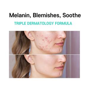 Soins de la peau, Centella Asiatica, crème hydratante éclaircissante, apaisante, atténuant les taches brunes, traitement du mélasma, crème pour le visage pour une peau éclatante - Product Image 6