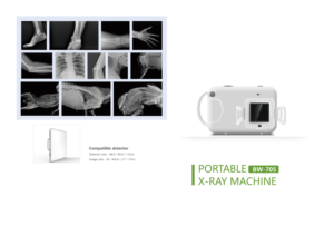 Máquina de Rayos X Digital Portátil con Pantalla Táctil de 7 Pulgadas, Certificación CE, Garantía de 1 Año para Uso Hospitalario y Veterinario - Product Image 4