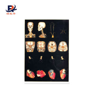 China Kenid Agfa Fuji Digunakan Dalam Pembuatan Film Thermal Medis Kering Printer Medis X-Ray Film - Product Image 1