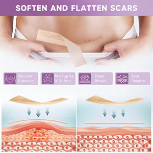 Patch de couverture élastique invisible en gel de silicone <span class=keywords><strong>pour</strong></span> la réparation des <span class=keywords><strong>cicatrices</strong></span> de césarienne rouge écarlate - Product Image 3