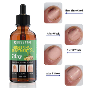 Gotas Suavizantes para Uñas Encarnadas al por Mayor, Tratamiento Reparador de Uñas con Jengibre, Ideal para Viajes, Fortalece las Uñas, Aceite para el Cuidado de las Uñas - Product Image 4