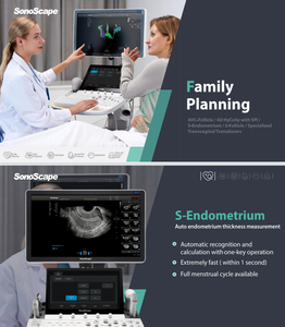 Échographe P60 Exp 4D 5D Sonoscape, appareil d'échographie, diagnostic par échographie, équipement médical pour hôpital - Product Image 4