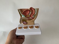 Modèles anatomiques du système urinaire masculin pour la science médicale, modèle de bassin masculin humain avec section de pathologie de la prostate