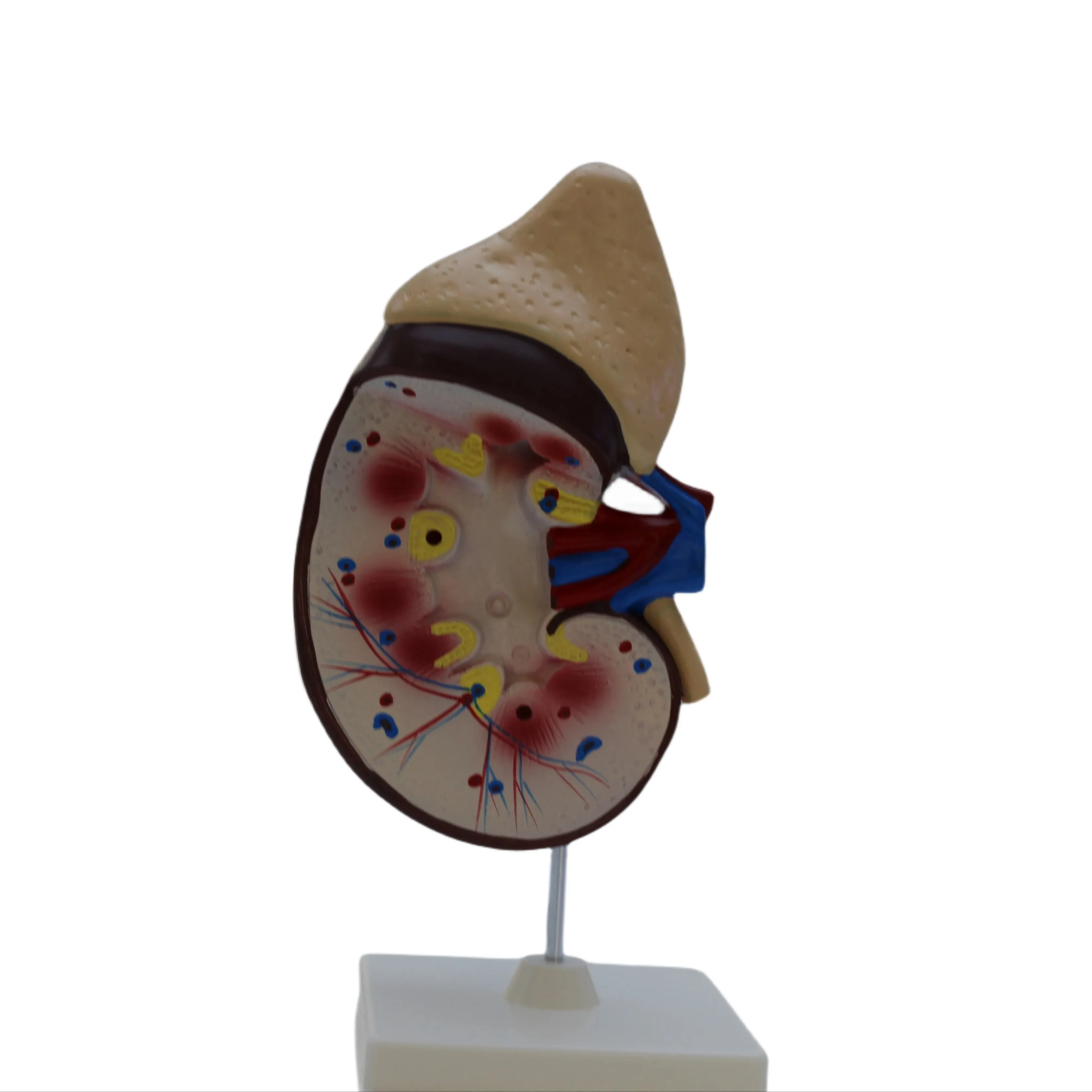 Anatomía del riñón modelo magnificado modelo de riñón órganos internos humanos demostración material didáctico modelo de enseñanza médica