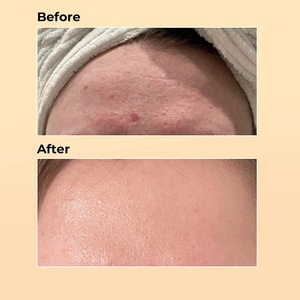 Tinh chất phục hồi mạnh mẽ từ chất nhầy ốc sên OEM 96%, giúp làn da sáng mịn, cải thiện độ đàn hồi, dưỡng ẩm, serum dưỡng da mặt nhẹ dịu. - Product Image 3