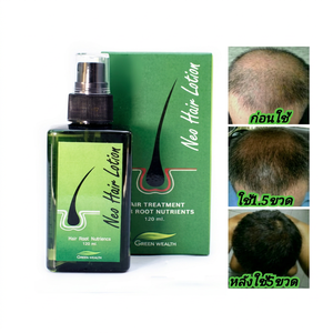 Spray de Tratamiento para el Crecimiento del Cabello, Aceite de Coco Orgánico, Uso Diario, Reparación Herbal, Refrescante, 120 ml, Venta al Por Mayor - Product Image 1