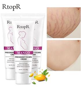 Mango Maternité Réparatrice Corps Crème Anti-âge Anti-Rides Raffermissante pour Cicatrices de Grossesse Acné Vergetures - Product Image 6