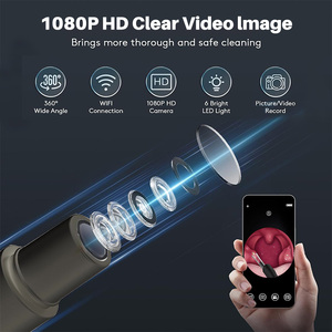 Removedor de Cálculos Amigdalinos Eléctrico Visible con Cámara HD y Control por Aplicación para Uso Doméstico en Adultos y Adolescentes - Product Image 6