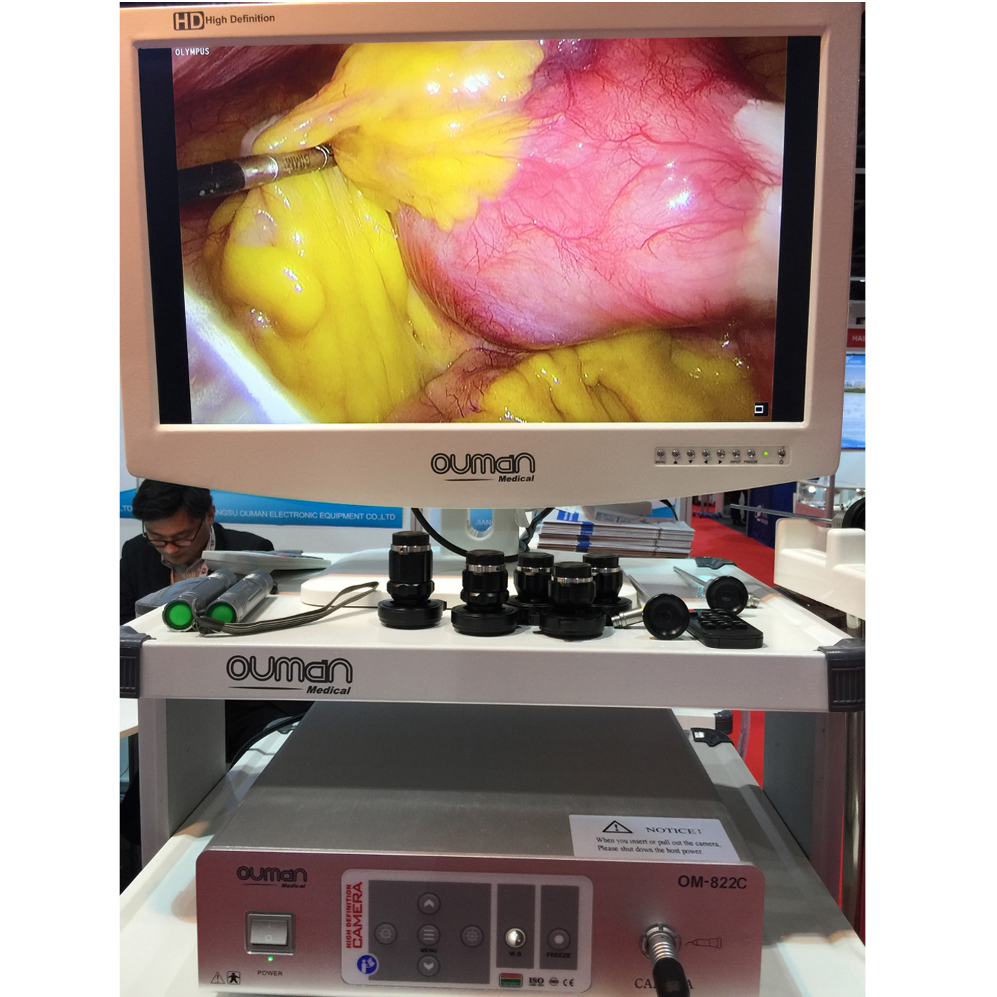 Full HD 1080P Мегапиксельная медицинская эндоскопическая камера OM-822C