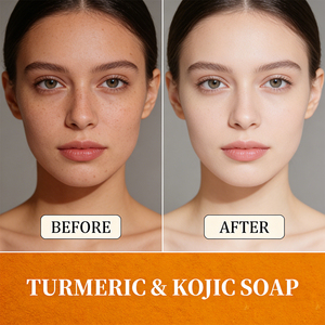 Hot Sale Pores Shrinking Moisturizing Brightening Bar Oil Controlling Turmeric Kojic Acid Cleansing <b>Soap</b> - Product Image 2