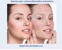 Sérum Concentré Anti-Âge au Peptide de Cuivre Bleu en Ampoule 3ml pour Peaux Mixtes, Anti-Rides, Raffermissant et Améliorant l'Élasticité