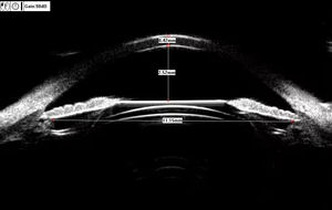 Alat USG Mata Portabel SW-3200S, USG Oftalmik Skala Penuh untuk Pemindaian Mata - Product Image 6