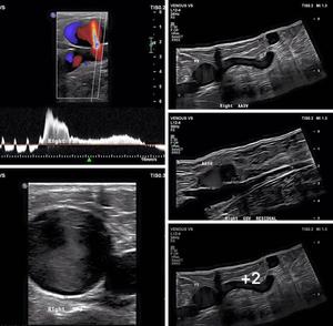 JM-906B pemindai Doppler warna portabel murah, Doppler warna 3D ultrasound untuk klinik - Product Image 6