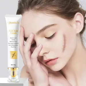 Alta Qualidade rosto Corpo Pele Reparação reduzir estrias Queimar Cicatriz Reparação Acne Cicatriz Remoção Creme cicatriz remoção creme