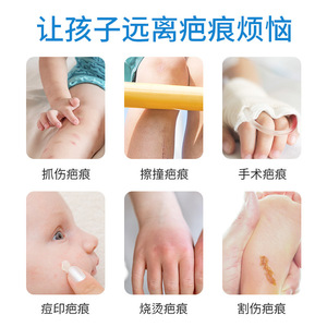 10 กรัม - Product Image 3