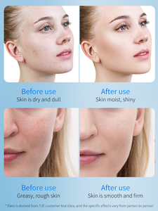 Ampolla de Oligopéptidos, Suero Natural para el Cuidado de la Piel, Líquido que Mejora la Opacidad, Hidrata la Barrera Cutánea, Calma la Piel del Rostro para Uso Privado - Product Image 3