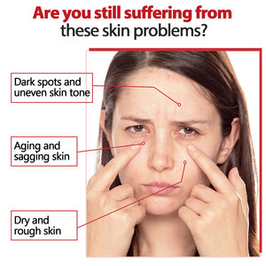 Hot Organic Retino Kojic Acid Cuidado DE LA PIEL Antienvejecimiento Arrugas Belleza Hidratante Blanqueamiento Kojic Acid Face Cream - Product Image 3