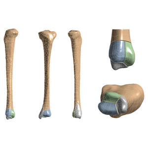 Ensemble professionnel d'instruments chirurgicaux orthopédiques en acier inoxydable de qualité médicale, kit autoclavable et réutilisable pour traumatologie - Product Image 2