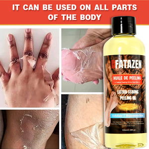 Huile exfoliante jaune en marque propre, formule de peeling extra forte, éclaircit la peau terne, adoucit les cuticules, huile de peeling pour éliminer les cicatrices - Product Image 2