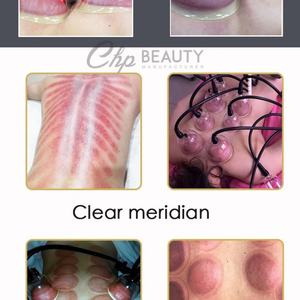 <b>Vacuum</b> <b>Therapy</b> Butt and Breast Enlargement <b>Machine</b> <b>Vacuum</b> <b>Therapy</b> <b>Machine</b> Massage Breast Enlargement Butt Enhance Cup - Product Image 6