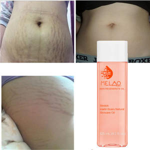 Aceite Corporal <span class=keywords><strong>de</strong></span> masaje para el cuidado <span class=keywords><strong>de</strong></span> la piel, aceite orgánico Natural <span class=keywords><strong>de</strong></span> maternidad para regenerar aceite, reparación <span class=keywords><strong>de</strong></span> cicatrices, eliminación <span class=keywords><strong>de</strong></span> estrías - Product Image 4
