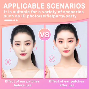 Hot bán Hydrocolloid dán tai mỹ phẩm Tai Corrector với băng dọc cho Veneer chỉnh và Thùy hỗ trợ - Product Image 3