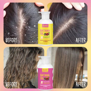 Best-seller Batana bio Shampooing <span class=keywords><strong>anti</strong></span>-<span class=keywords><strong>chute</strong></span> Huile de batana végétalienne <span class=keywords><strong>Traitement</strong></span> capillaire Croissance Shampooing et après-shampoing - Product Image 6