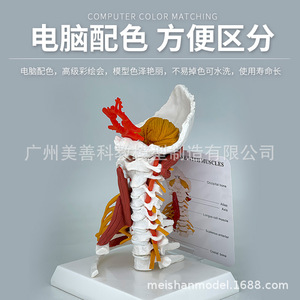Modèle avancé des muscles de la colonne cervicale, de l'artère carotide, de l'os occipital, du disque intervertébral et des nerfs ; colonne cervicale humaine - Product Image 4
