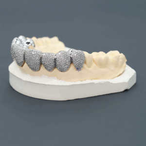 Grillz de Lujo de Plata de Ley 925 con Diamantes de Moissanita para Hombres y Mujeres, Joyería Única de Hip Hop con Dientes Personalizados Iced Out - Product Image 2