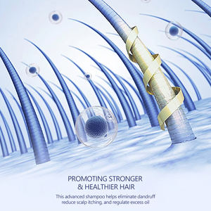 Shampooing professionnel anti-pelliculaire avec arbre à thé Oi apaiser les <span class=keywords><strong>démangeaisons</strong></span> réduire la flaccidité rafraîchir le shampooing de lavage des cheveux du <span class=keywords><strong>cuir</strong></span> <span class=keywords><strong>chevelu</strong></span> - Product Image 5