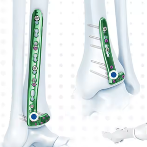 <span class=keywords><strong>Vis</strong></span> à os pour pieds, plaques de fixation pour fractures de la <span class=keywords><strong>cheville</strong></span> - Product Image 3