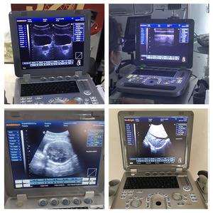 Ecógrafo Veterinario Portátil con Certificación CE, Económico, en Blanco y Negro, 3D, <span class=keywords><strong>Transvaginal</strong></span> - Product Image 2