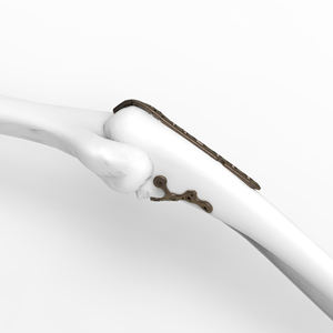 Implante Ortopédico de Aleación de Titanio CANWELL, Placa en T de Bloqueo para Únula Proximal, Sistema de Fijación Interna para Fracturas Óseas, <span class=keywords><strong>CE</strong></span> - Product Image 4