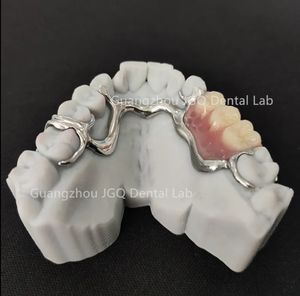 Marco dental de titanio de último diseño con <span class=keywords><strong>dentaduras</strong></span> acrílicas Precio perfecto asequible - Product Image 5