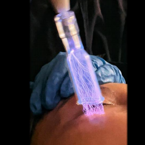 Teknologi Plasma Terbaru Perawatan Kosmetik LED Desktop Mengurangi Efek Anti-Penuaan Cepat Efektif Mengontrol Infeksi - Product Image 2