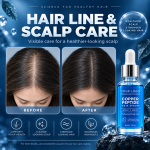 Sérum para el Cuero Cabelludo GHK-CU, Nutre, Repara el Cabello Dañado, Hidrata, Calma el Cuero Cabelludo Seco, Mejora el Cabello Fino, Superventas - Product Image 2