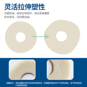 Steadlive Ostomy Leak Proof <b>Rings</b> 2mm <b>Thickness</b> Stoma Care Supplies for All Skin Types - Product Image 2