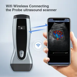 Wifi Yonker 더블 프로브 미니 휴대용 암소 애완 동물 및 휴대용 기계 수의사 수의학 초음파 스캐너 모니터