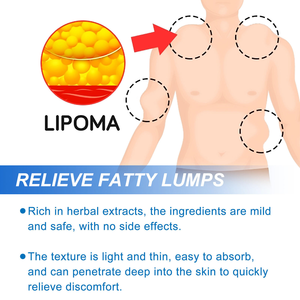 Crème corporelle à base de plantes pour soulager les nœuds et les bosses graisseux sur les jambes et le dos - Product Image 5