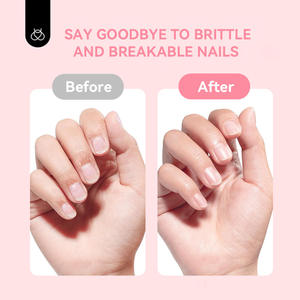 Agent <span class=keywords><strong>de</strong></span> renforcement et <span class=keywords><strong>de</strong></span> réparation des ongles Liquide <span class=keywords><strong>de</strong></span> durcissement pour vernis à ongles cassants Produit <span class=keywords><strong>de</strong></span> réparation des ongles <span class=keywords><strong>de</strong></span> qualité supérieure - Product Image 3