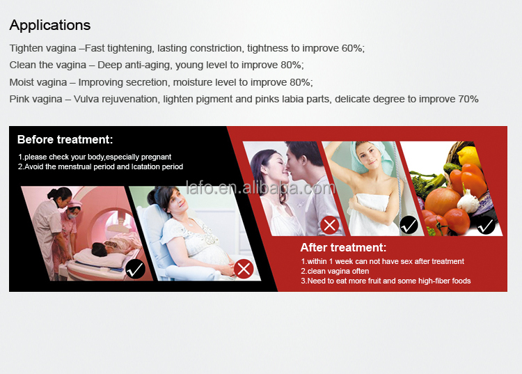 co2 l tightening laser/portable l tightening machine/fractional co2 laser l tightening machine