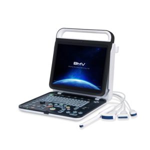 BMV BPU60C Veterinária Ultrassom Máquina 3D/4D Cor Doppler B/W Imagem USB Recarregável CE Certificado Classe II 2 Anos de Garantia - Product Image 2
